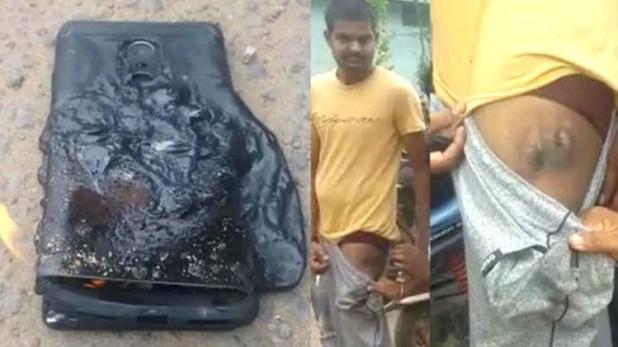 जाबोमीको ‘रेडमी नोट फोर’ गोजीमा नै पड्किँदा युवक घाईते, कम्पनीले अनुसन्धान गर्दै