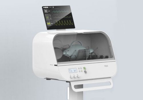 स्मार्टवाच बनाउने कम्पनी फिटबिटले बनायो आपतकालीन भेन्टिलेटर