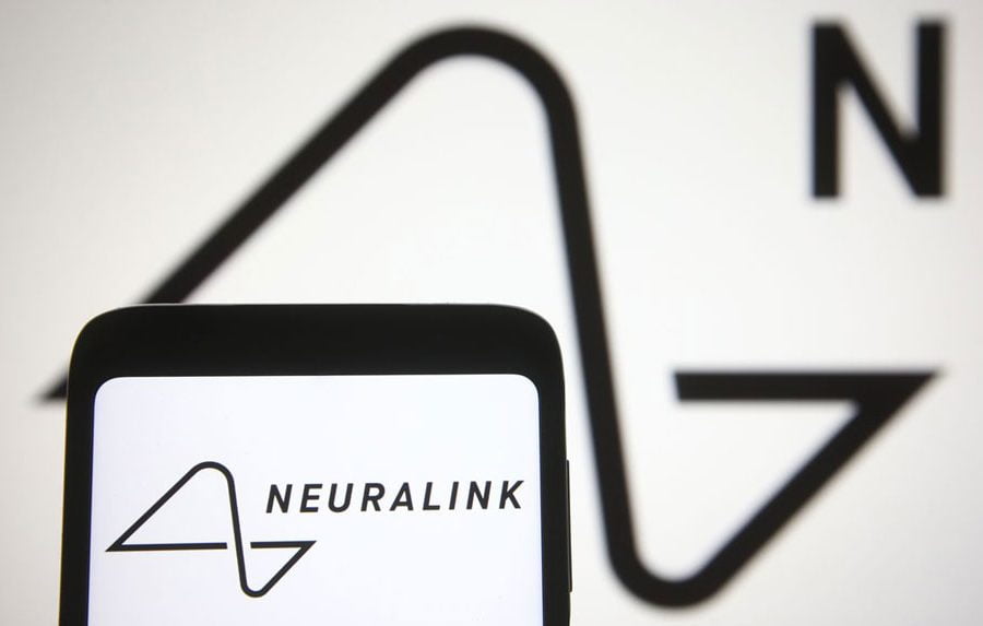 मस्कको अलौकिक दृष्टिको प्रतिज्ञा खतरनाक छ– शोधकर्ताहरू