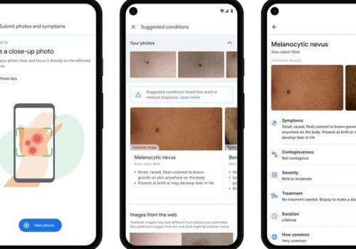 गुगलको एआई टूलले बिरामीको चर्म रोग पत्ता लगाउन सघाउ पुर्याउने
