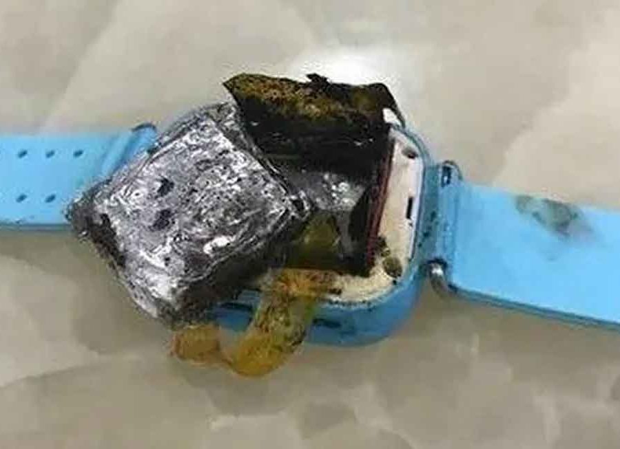 चीनमा चार वर्षिया बालिकाको नाडीमा अचानक पड्कियो स्मार्टवाच