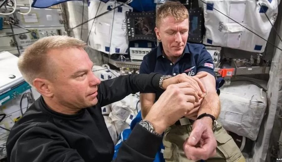 अन्तरिक्ष यात्राले मानिसको शरीरमा कस्तो असर पार्छ? के यी घातक हुन्छन्?