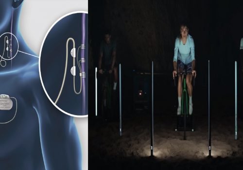 स्नायु-उत्तेजना बढाउने डिभाइसले पक्षघात भएकाहरुलाई हिँड्न र साइकल चलाउन सघायो