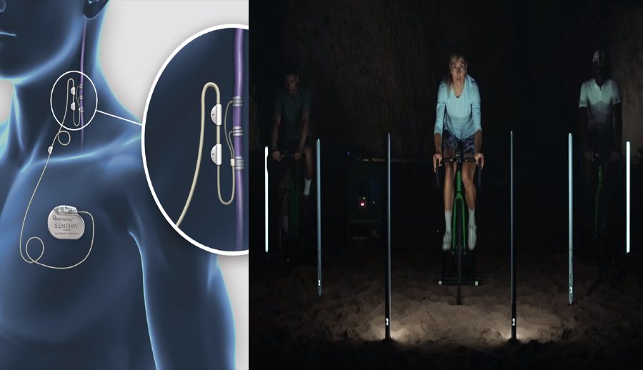 स्नायु-उत्तेजना बढाउने डिभाइसले पक्षघात भएकाहरुलाई हिँड्न र साइकल चलाउन सघायो