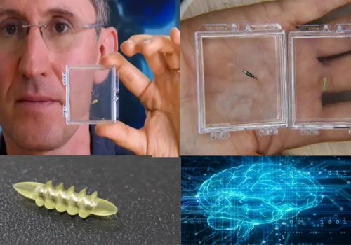 अब रोबोटले दिमागमा गएर मानसिक रोगको उपचार गर्ने