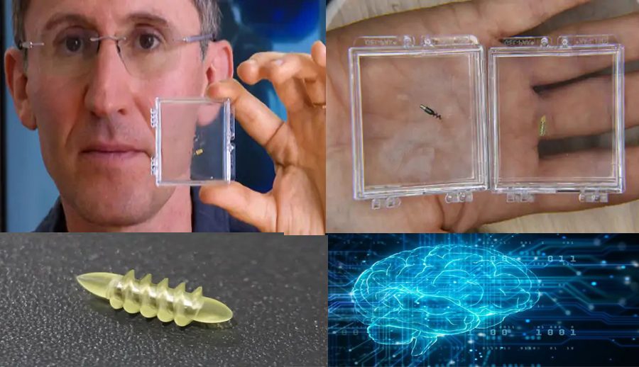 अब रोबोटले दिमागमा गएर मानसिक रोगको उपचार गर्ने