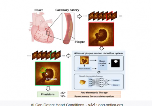 आर्टिफिसियल इन्टेलिजेन्सको माध्यमबाट हृदयघातको जानकारी अग्रिम पाउन सकिने