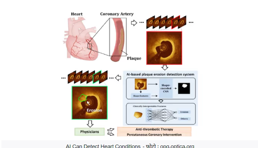 आर्टिफिसियल इन्टेलिजेन्सको माध्यमबाट हृदयघातको जानकारी अग्रिम पाउन सकिने