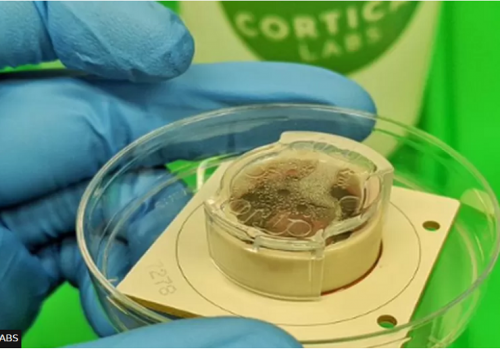 प्रयोगशालामा विकसित मस्तिष्क कोशिकाले भिडियो गेम खेल्यो