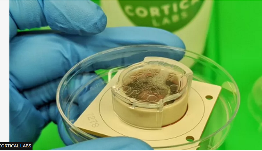 प्रयोगशालामा विकसित मस्तिष्क कोशिकाले भिडियो गेम खेल्यो