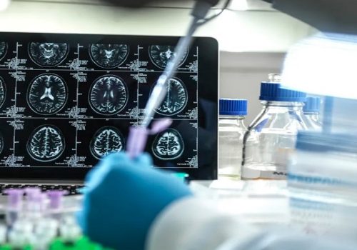 अब अल्जाइमर रगत परीक्षणबाट पत्ता लाग्ने