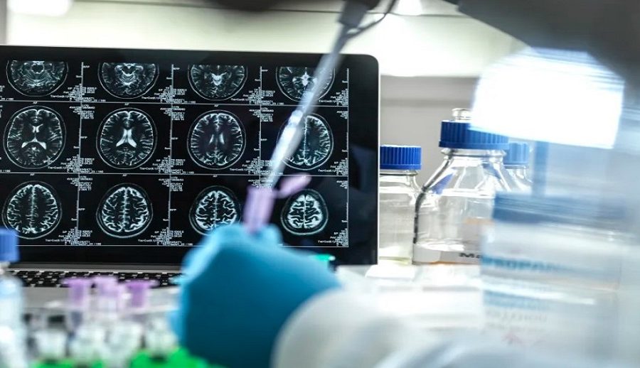 अब अल्जाइमर रगत परीक्षणबाट पत्ता लाग्ने