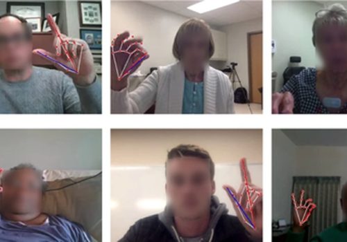 पार्किन्सनको गम्भीरताका लागि अनलाइन एआई-आधारित परीक्षणले देखायो आशाजनक परिणाम