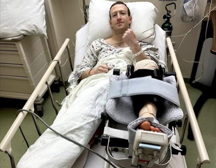 घुँडामा चोट लागेपछि मेटाका मालिक मार्क जुकरबर्गको शल्यक्रिया