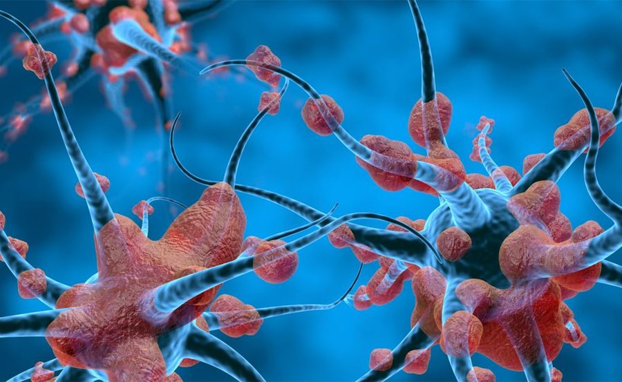 भारतीय वैज्ञानिकहरूले हात र नाडीको नशा विकारको उपचार गर्न बनाए एआई टूल