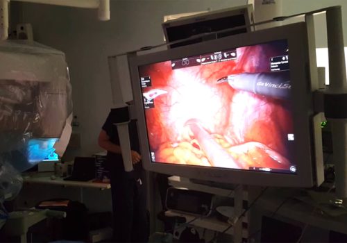 वैज्ञानिकहरूले क्यान्सर कोशिकाहरूमा टाँसिने चम्किलो डाई विकास गरे