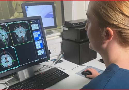 एआईमार्फत् १६ लाख मस्तिष्कको स्क्यान परीक्षण गरेर डिमेन्सिया रोगको जोखिम पूर्वानुमान गरिँदै