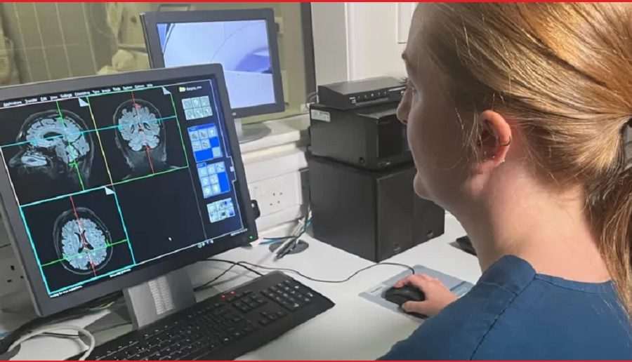 एआईमार्फत् १६ लाख मस्तिष्कको स्क्यान परीक्षण गरेर डिमेन्सिया रोगको जोखिम पूर्वानुमान गरिँदै