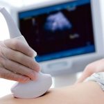 सर्लाहीको पर्सा गाउँपालिकाले शुरु गर्यो ग्रामीण अल्ट्रासाउन्ड सेवा