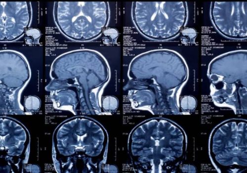अब एक्सरे, एमआरआई तथा सिटीस्क्यानको रेडियोलोजी फिल्मको सट्टा डिजिटल रिपोर्टमात्र दिइने, शुल्क पनि घट्ने