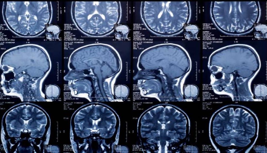 अब एक्सरे, एमआरआई तथा सिटीस्क्यानको रेडियोलोजी फिल्मको सट्टा डिजिटल रिपोर्टमात्र दिइने, शुल्क पनि घट्ने