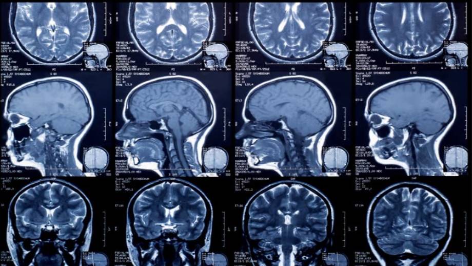 अब एक्सरे, एमआरआई तथा सिटीस्क्यानको रेडियोलोजी फिल्मको सट्टा डिजिटल रिपोर्टमात्र दिइने, शुल्क पनि घट्ने