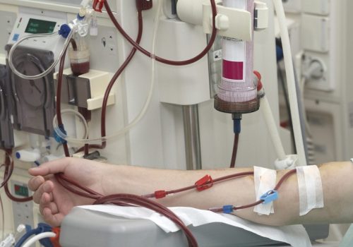 बागमती प्रदेशका विभिन्न अस्पतालमा १६ वटा डायलासिस मेसिन जडान