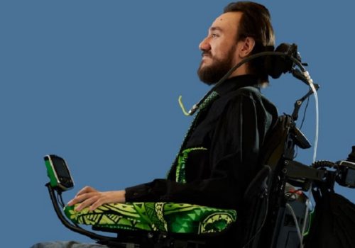 इलन मस्कको कम्पनीले पक्षघातले ग्रस्त बिरामीको मस्तिष्कमा ‘ब्रेन चिप’ राखेपछि यसरी बदलियो उनको जीवन