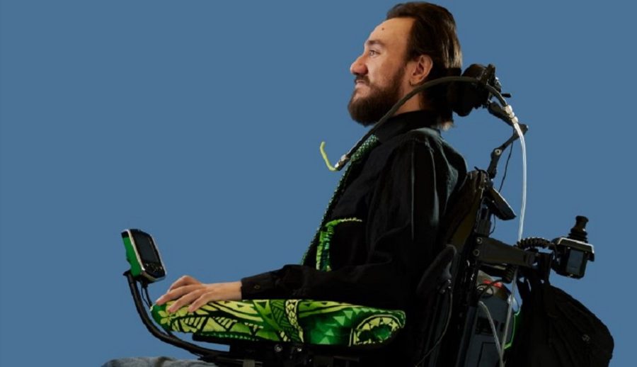 इलन मस्कको कम्पनीले पक्षघातले ग्रस्त बिरामीको मस्तिष्कमा ‘ब्रेन चिप’ राखेपछि यसरी बदलियो उनको जीवन