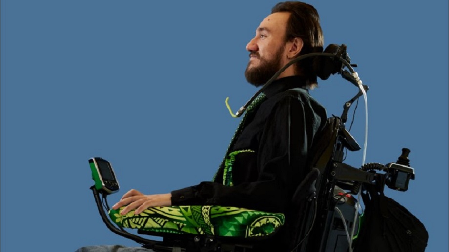 इलन मस्कको कम्पनीले पक्षघातले ग्रस्त बिरामीको मस्तिष्कमा ‘ब्रेन चिप’ राखेपछि यसरी बदलियो उनको जीवन