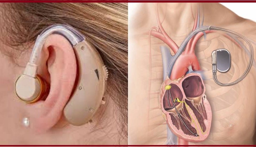 दश महिनामा सरकारले भित्र्यायो साढे १४ करोडमाथिका हियरिङ एड र पेसमेकर