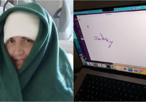 न्यूरालिङ्क ब्रेन चिप प्रयोग गरेर २० वर्षपछि पक्षघात पीडित महिलाले आफ्नै नाम लेखिन्