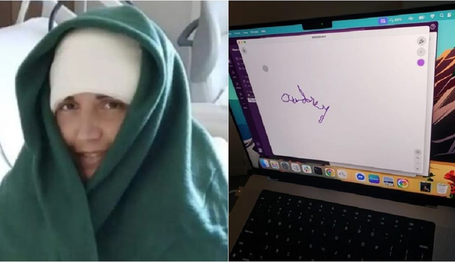 न्यूरालिङ्क ब्रेन चिप प्रयोग गरेर २० वर्षपछि पक्षघात पीडित महिलाले आफ्नै नाम लेखिन्