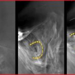 पार्कर सोलर प्रोबले कीर्तिमानी दूरीबाट खिच्यो सूर्यका गतिविधिको यस्तो तस्बिर
