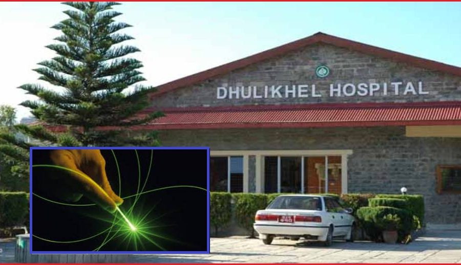 धुलिखेल अस्पतालमा नयाँ थुलियम लेजर प्रविधिबाट पत्थरीको उपचार शुरु