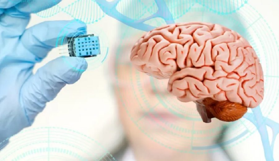 वैज्ञानिकहरूले विकास गरे पासवर्डमार्फत् मस्तिष्क पढ्न सक्ने प्रणाली, यसरी काम गर्छ