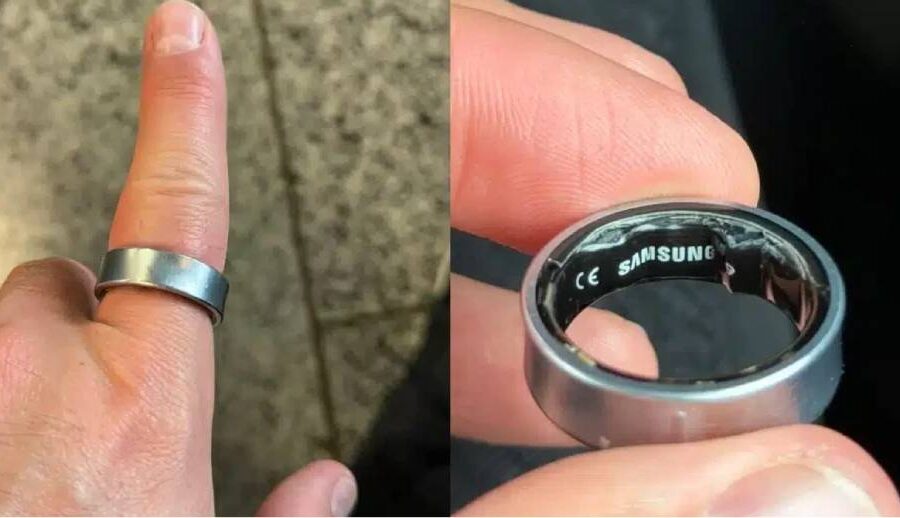 जब सामसङको ग्यालेक्सी रिङ प्रयोगकर्ताको औंलामै अड्कियो…