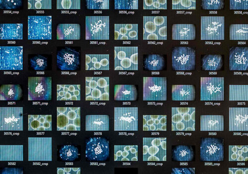 मानव मिनी–मस्तिष्कले चलाउँदैछ नयाँ पुस्ताको कम्प्युटर ‘वेटवेयर’