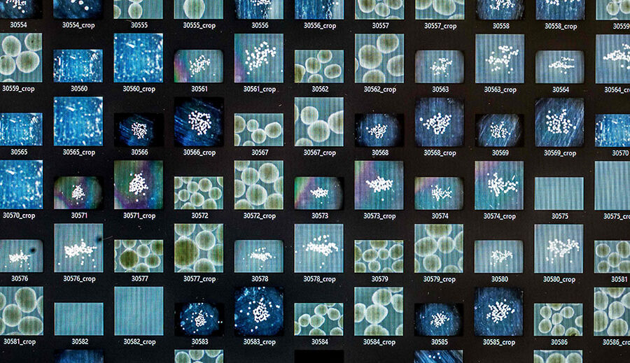 मानव मिनी–मस्तिष्कले चलाउँदैछ नयाँ पुस्ताको कम्प्युटर ‘वेटवेयर’