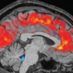 थकान महसुस हुँदा दिमागले यसकारण ध्यान केन्द्रित गर्न सक्दैन: रिपोर्ट