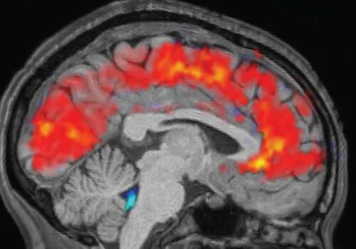 थकान महसुस हुँदा दिमागले यसकारण ध्यान केन्द्रित गर्न सक्दैन: रिपोर्ट