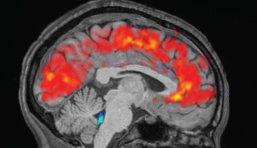 थकान महसुस हुँदा दिमागले यसकारण ध्यान केन्द्रित गर्न सक्दैन: रिपोर्ट