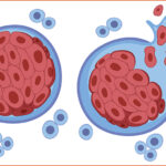 फ्रान्सेली वैज्ञानिकद्वारा क्यान्सर उपचारमा एमआरएनएको सम्भाव्यता परीक्षण
